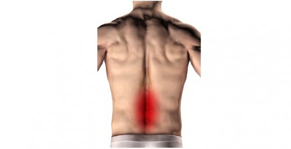 Illustration of human back with red area indicating lower back pain